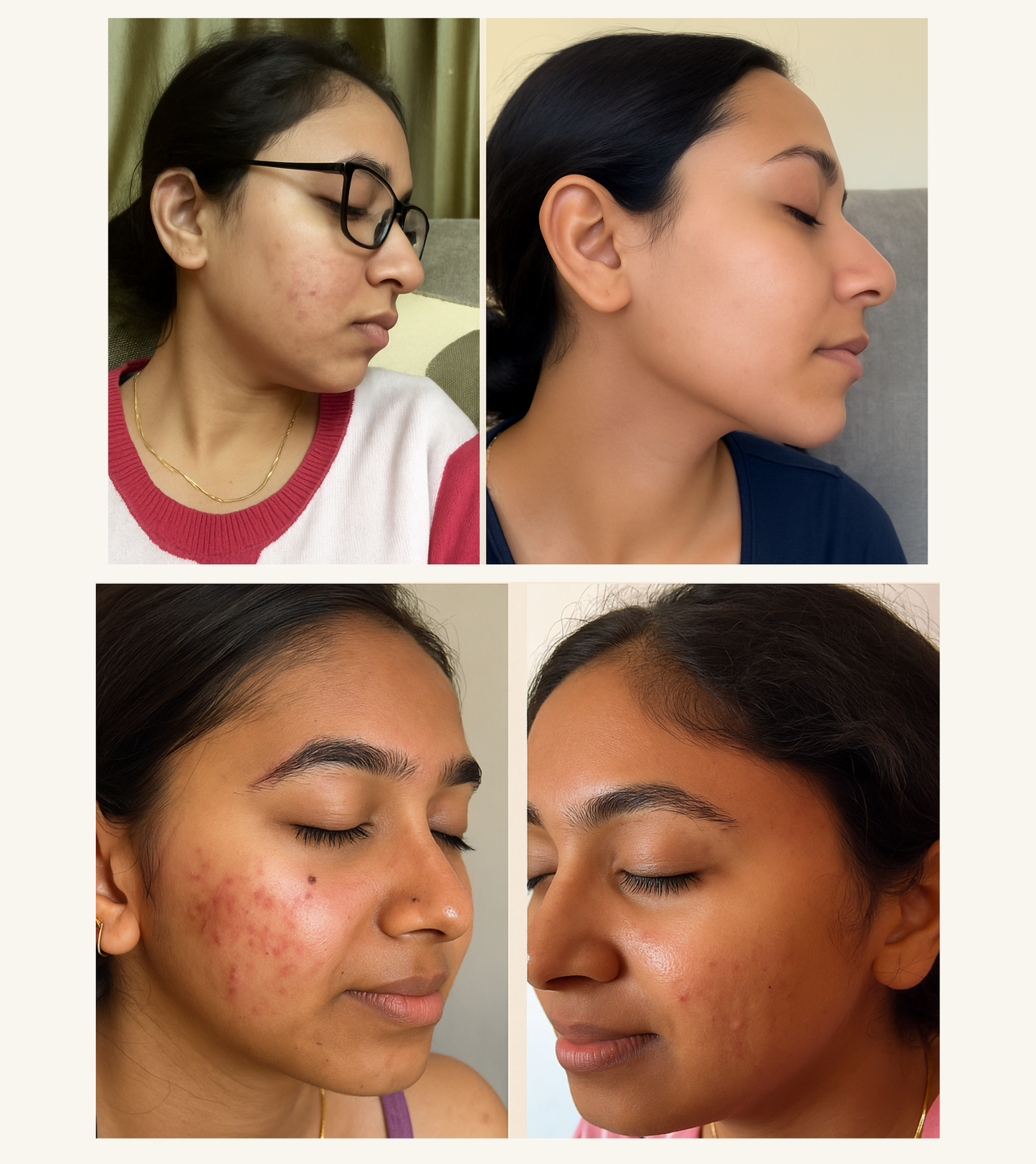 RAAMYA Acne Cleansing Balm Scrub